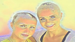 Can hair grow back after alopecia universalis? How long does it take to lose all hair on alopecia universalis? Does alopecia universalis ever go away? How do you stop your immune system from attacking hair follicles?
